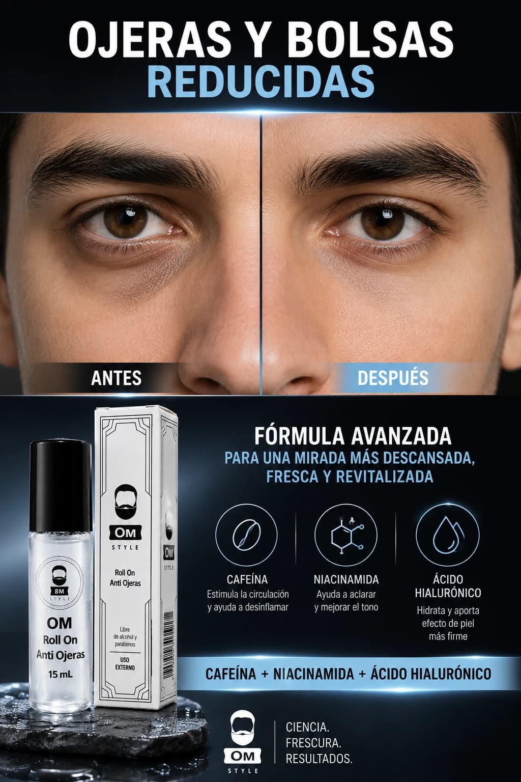 Comparación ilustrativa antes y después para OM STYLE Anti Ojeras